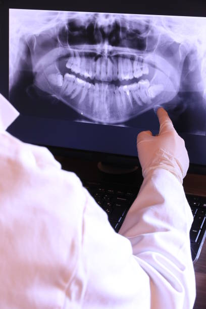 Best Emergency Tooth Extraction in South Sumter, SC