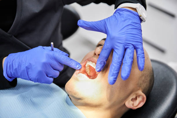 Best Emergency Treatment for Dental Infections or Abscesses in South Sumter, SC